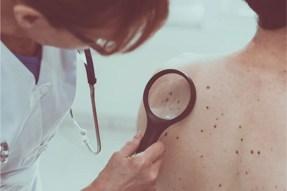 avancos-tecnologicos-prevenir-cancer-pele